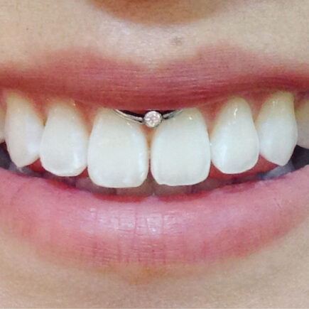 piercing-no-smile